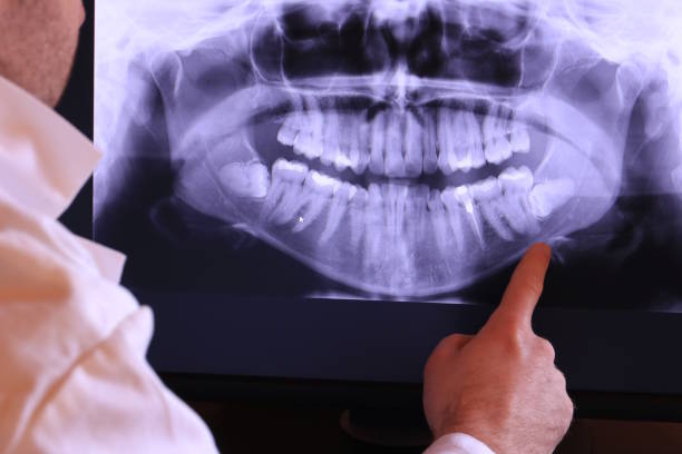 Best Pediatric Emergency Dentist in Murrells Inlet, SC